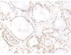 兔抗ARL2BP多克隆抗体