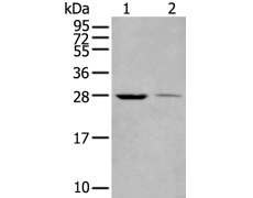 兔抗WBP1多克隆抗体