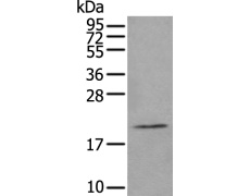 兔抗ARL8A多克隆抗体