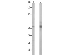 兔抗ARMC6多克隆抗体