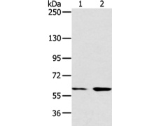 兔抗ATG16L1多克隆抗体