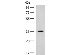 兔抗ATP1B2多克隆抗体