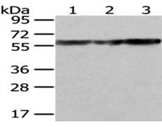 兔抗ATP5A1多克隆抗体