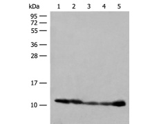 兔抗ATP5ME多克隆抗体