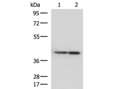 兔抗ATP6V1C1多克隆抗体 