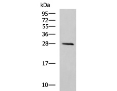 兔抗ATP6V1D多克隆抗体