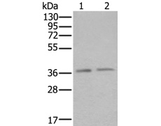 兔抗ATXN7L3多克隆抗体