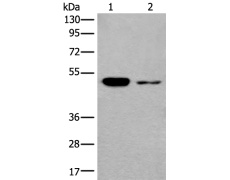 兔抗B3GNT3多克隆抗体