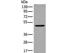 兔抗B4GAT1多克隆抗体