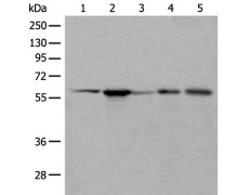 兔抗BAIAP2L1多克隆抗体