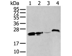 兔抗BCAS4多克隆抗体