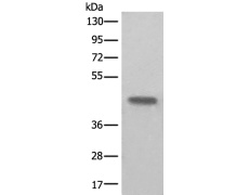 兔抗BHMT2多克隆抗体