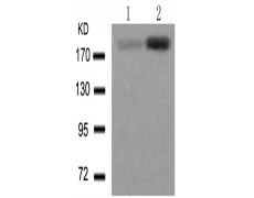 兔抗BRCA1 (Phospho-Ser1423)多克隆抗体