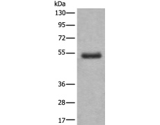 兔抗BTBD6多克隆抗体