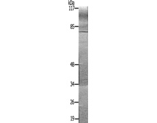 兔抗BTK(Ab-222)多克隆抗体