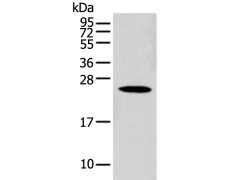 兔抗C1QTNF3多克隆抗体
