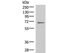 兔抗C19orf57多克隆抗体
