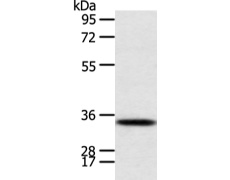 兔抗CALB2多克隆抗体