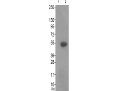 兔抗CAMK2B/CAMK2D(Phospho-Thr305)多克隆抗体