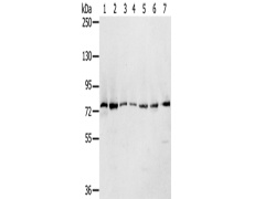 兔抗CAPN7多克隆抗体