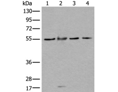 兔抗WDSUB1多克隆抗体 