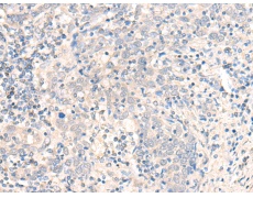 兔抗CCDC47多克隆抗体