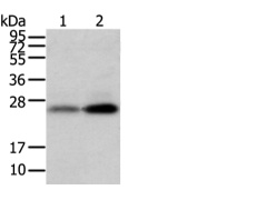  兔抗WFDC5多克隆抗体 