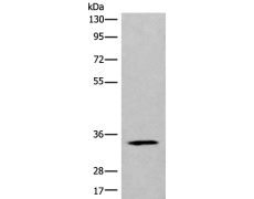 兔抗CCDC137多克隆抗体