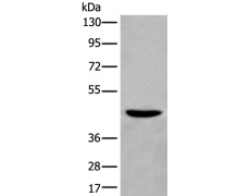 兔抗WIPI2多克隆抗体 