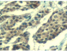 兔抗CCNB1 (phospho-Ser147)多克隆抗体