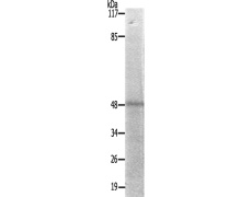 兔抗CCNE1(Ab-395)多克隆抗体
