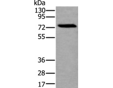兔抗XPNPEP2多克隆抗体