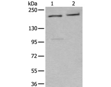 兔抗XRN1多克隆抗体