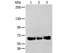 兔抗ZBTB5多克隆抗体 