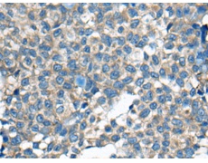 兔抗ZC2HC1A多克隆抗体 