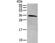 兔抗CDC34多克隆抗体