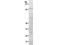 兔抗CDH8多克隆抗体