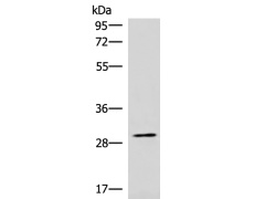 兔抗CDK4多克隆抗体