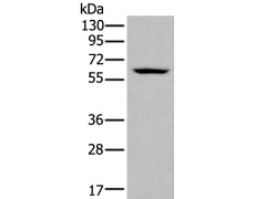 兔抗ZNF76多克隆抗体