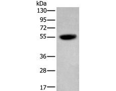 兔抗CDK14多克隆抗体