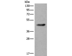 兔抗CDKL4多克隆抗体