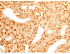 兔抗CDKN2AIPNL多克隆抗体