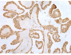 兔抗ZNF281多克隆抗体