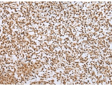 兔抗ZNF354A多克隆抗体