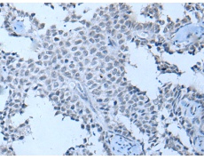 兔抗ZNF703多克隆抗体