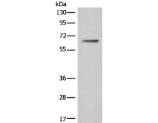 兔抗CEP57多克隆抗体