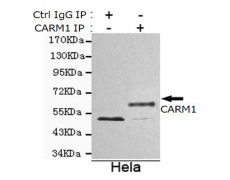 小鼠抗CARM1单克隆抗体   
