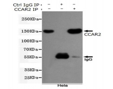 小鼠抗CCAR2单克隆抗体    