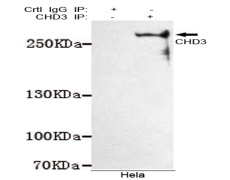 小鼠抗CHD3(C-term)单克隆抗体 