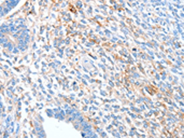 兔抗ALDH1A2多克隆抗体